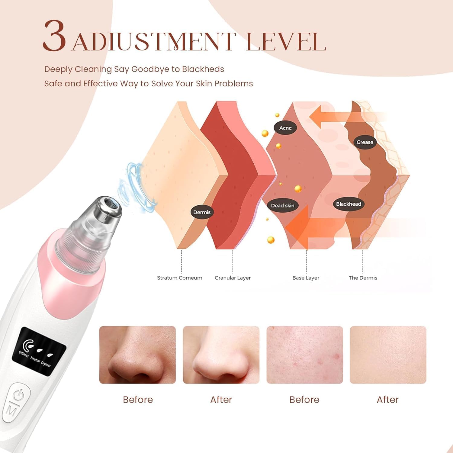 Gackoko pore cleaner with 5 probes for versatile skin treatment