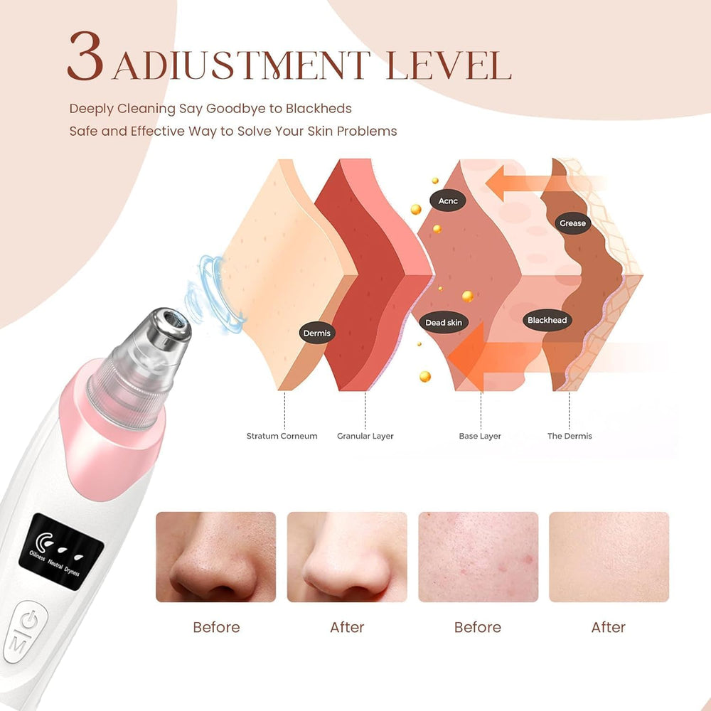Gackoko pore cleaner with 5 probes for versatile skin treatment