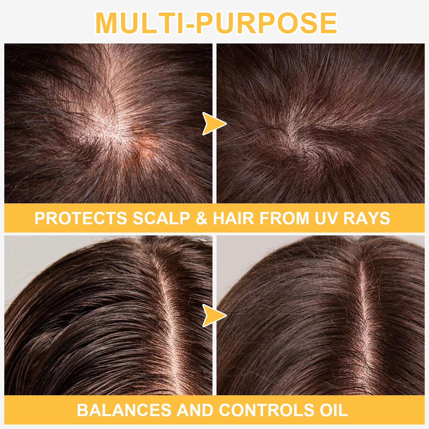 GADMLURY scalp application during outdoor activities like hiking