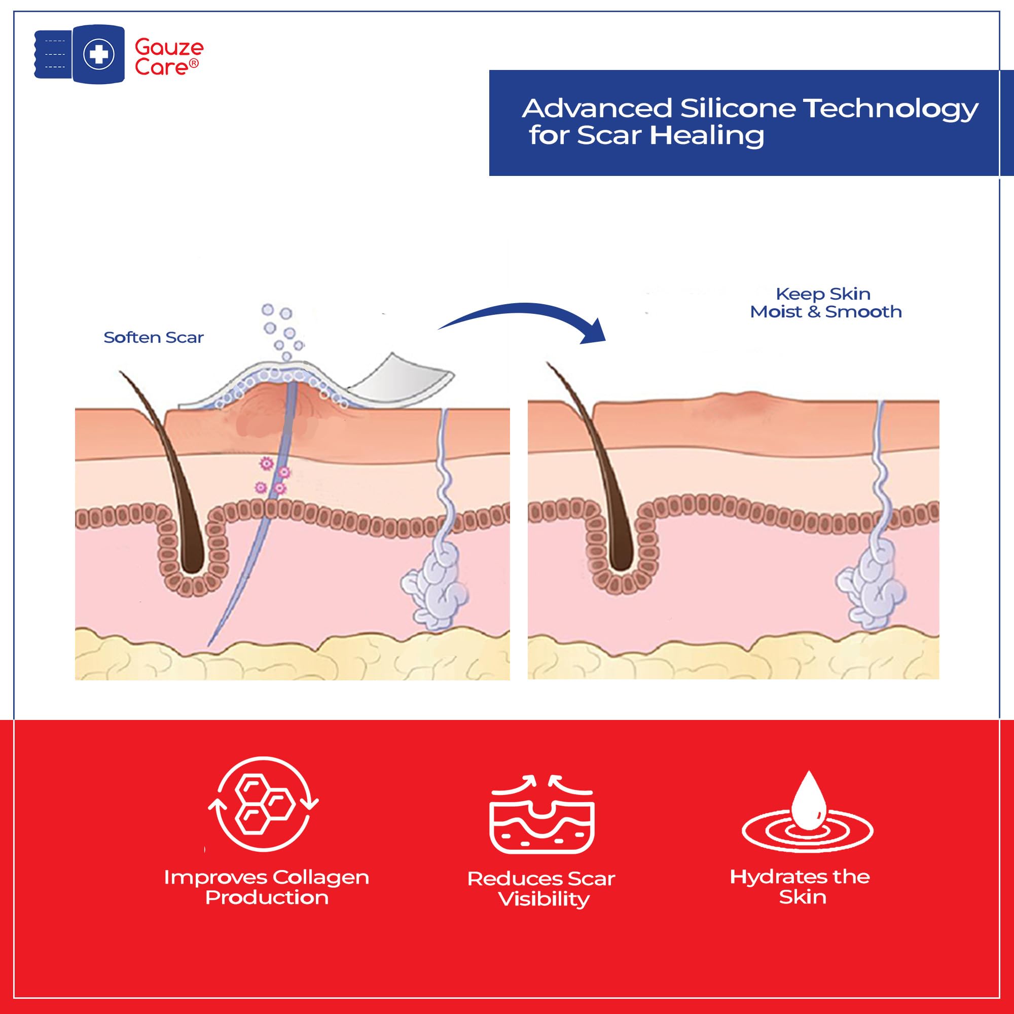 Gauze Care: tira silicona para cicatrices apta para ducha y ejercicio.