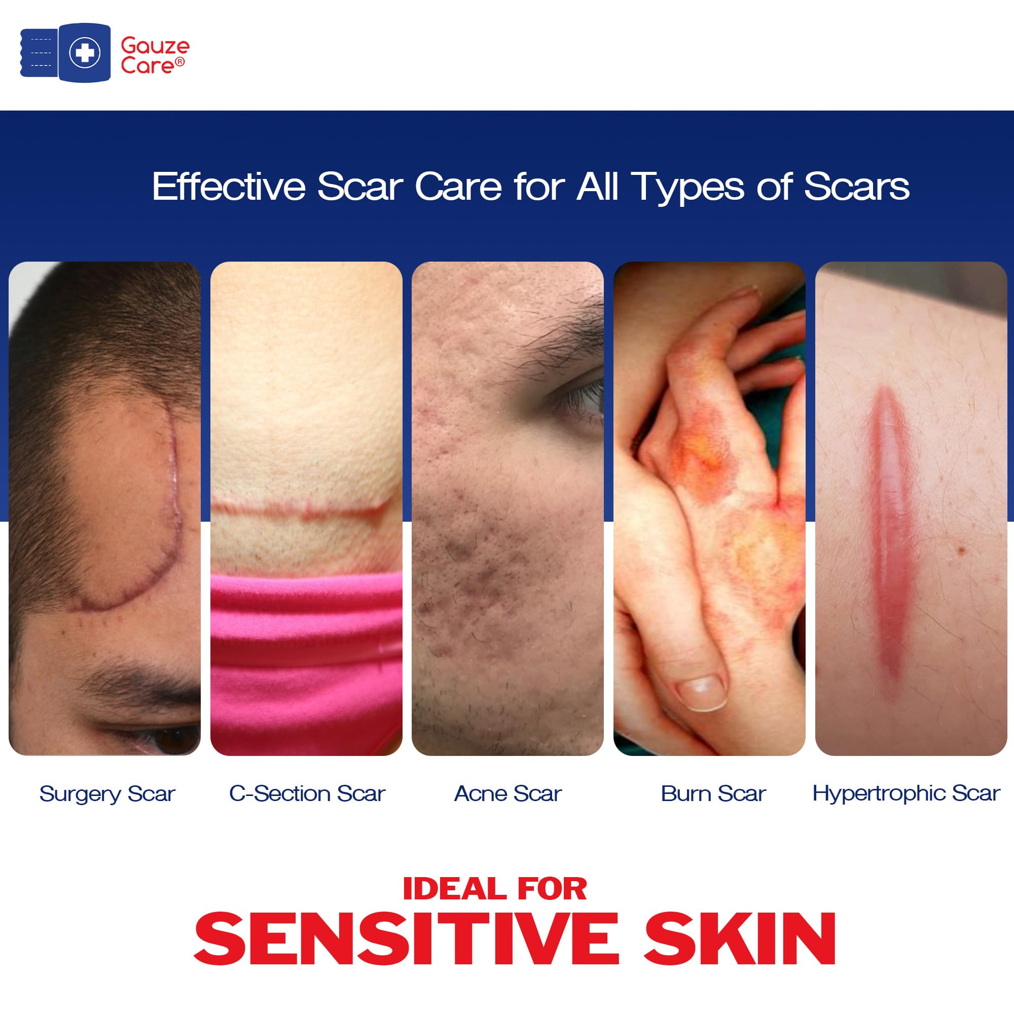 Gauze Care: tira cicatriz silicona reutilizable para cuidado a largo plazo.