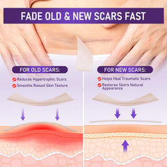 GEIMIY cinta de silicona médica para queloides y bultos; uso consistente para suavizar textura