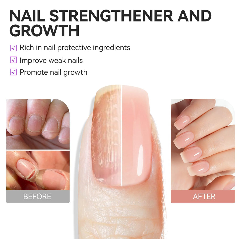gelike ec damaged-nail-closeup showing treated, healthier-looking nails