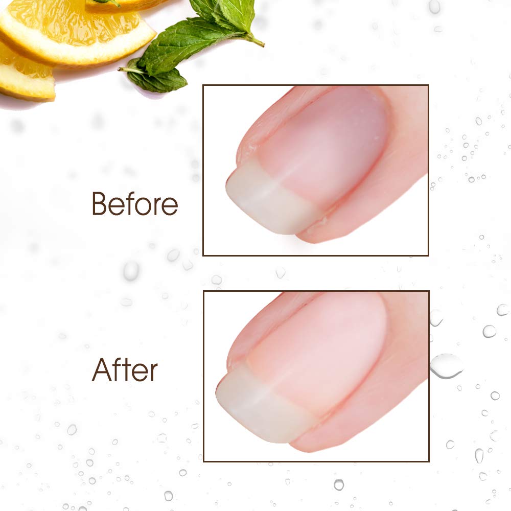 Gena Nail Brite nails with visible discoloration before whitening