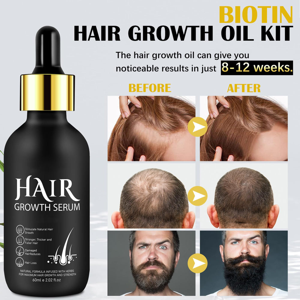 Suero de biotina para cabello, fortalece y revitaliza.