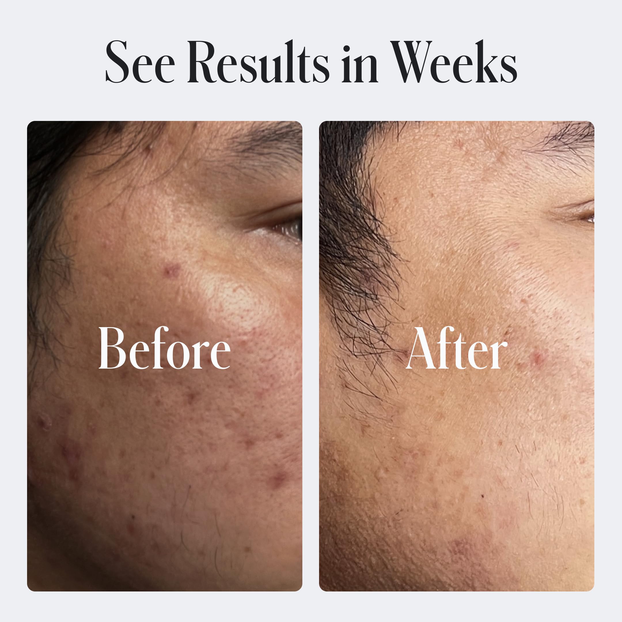Geologie Skin Repair Moisturizer ingredient panel highlights niacinamide benefits.