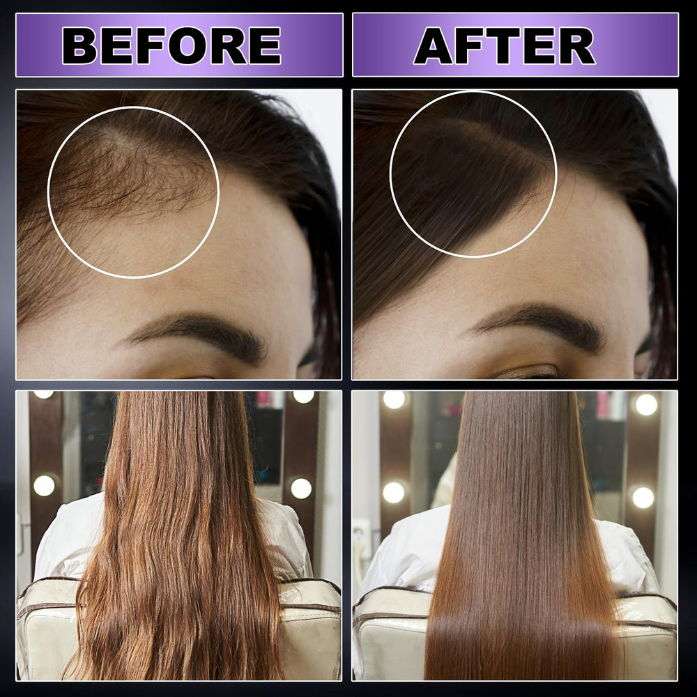 GIFBEA cafeína activa el cabello para mayor volumen.