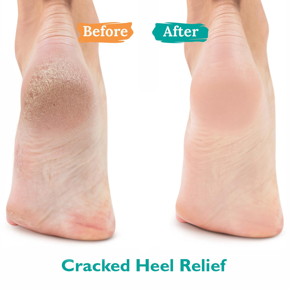GILDEN TREE Urea Gel 42% con textura clara y rápida absorción.