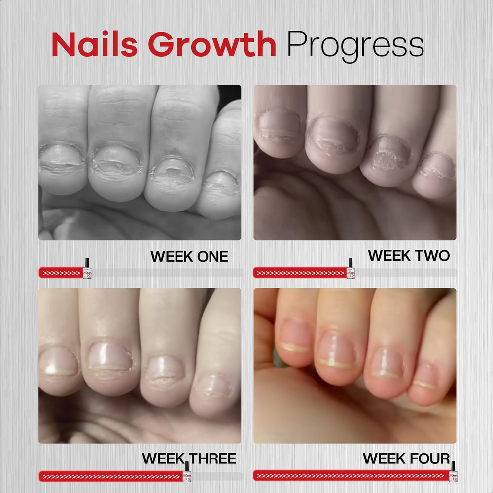 Glamonade nail-repair-growth visualization suggests support for healthier nail development
