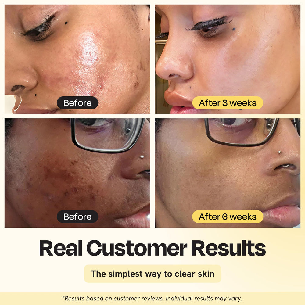 Gleamin mask being applied to cheek for a quick 10-minute glow reset