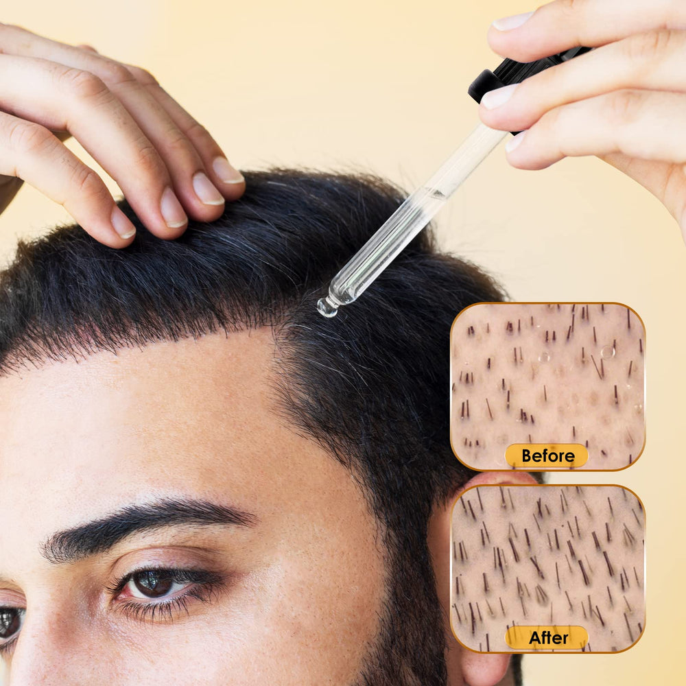Glemme Minoxidil easy daily routine image demonstrates simple application.