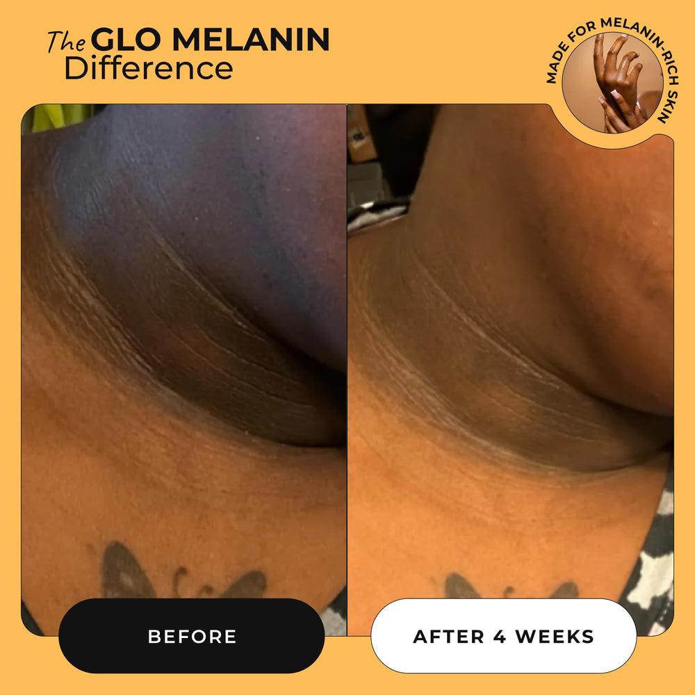 Glo Melanin: crema mágica para axilas, mejora claridad de piel.