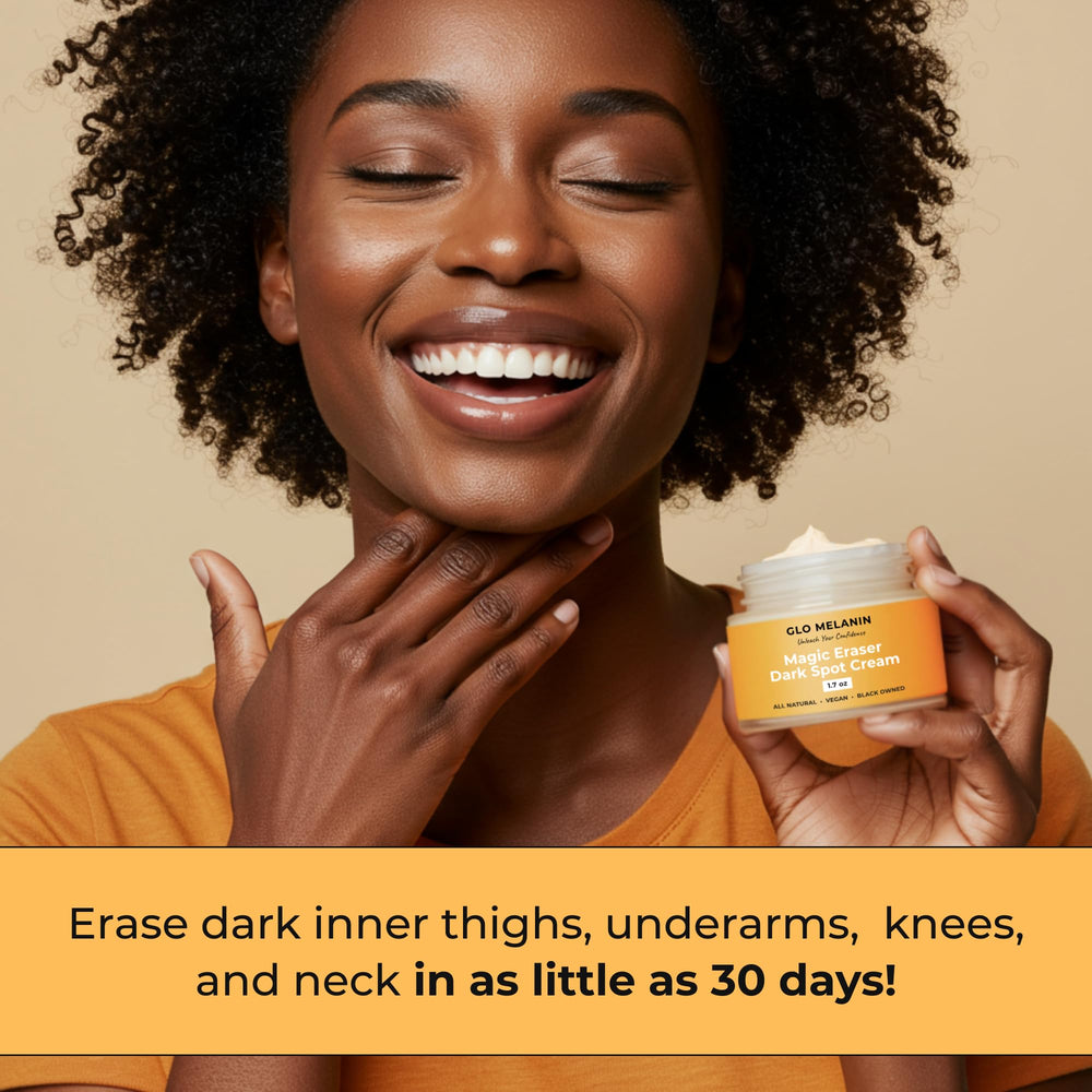 Glo Melanin: crema mágica para manchas corporales, cuidado suave y efectivo.