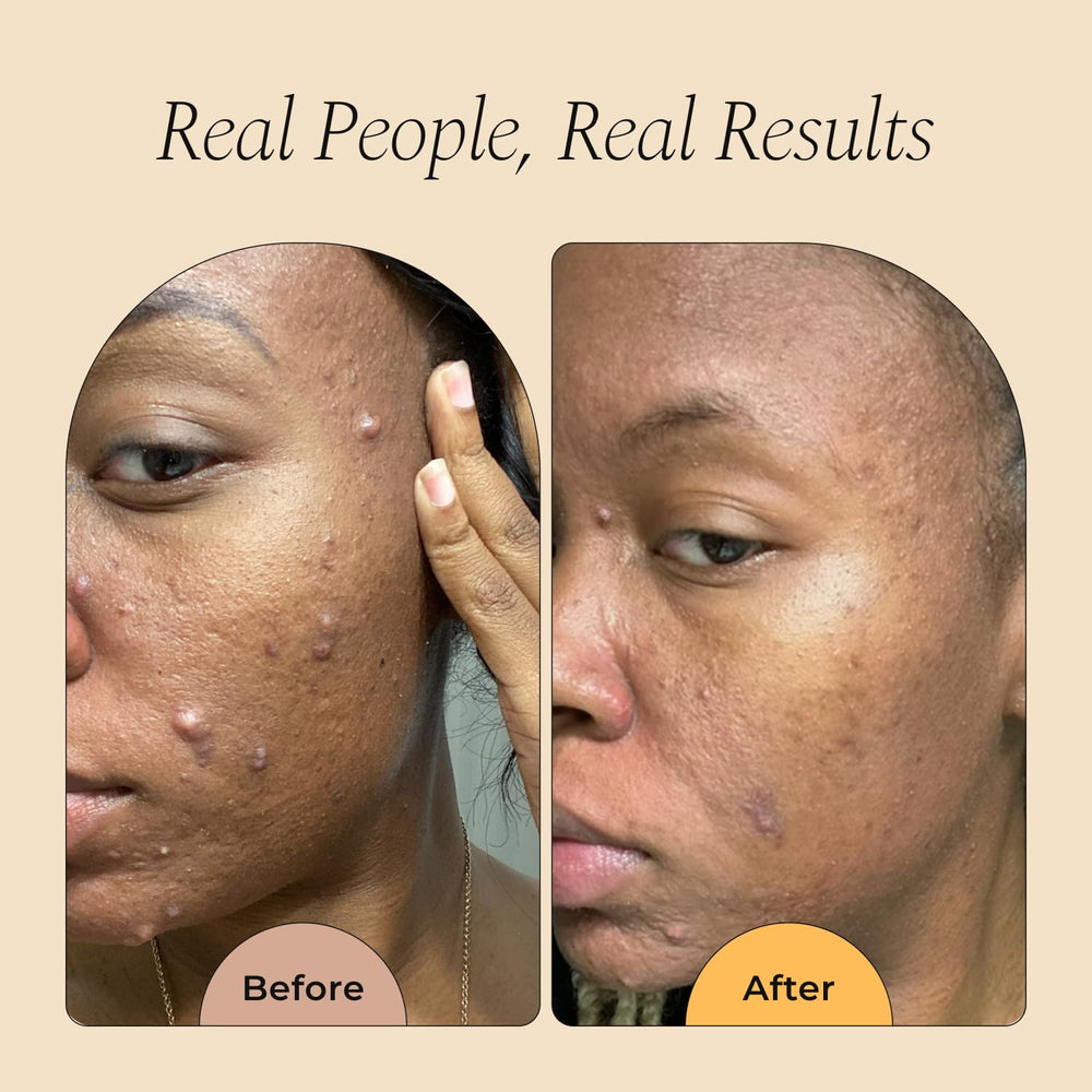 Glo Melanin rose water formula nourishes while cleansing for balanced hydration.