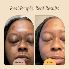 Glo Melanin serum application on cheek suggests even-toned skin over time.