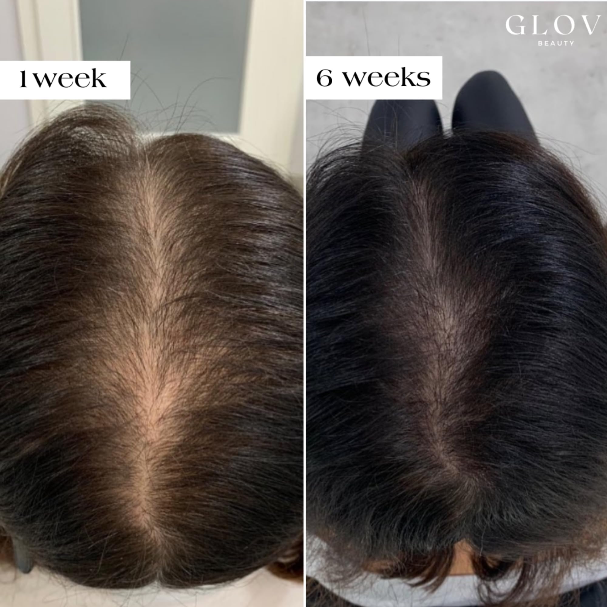 Glov Beauty peptide serum ampoules deliver 5ml each for nourishing scalp hydration.