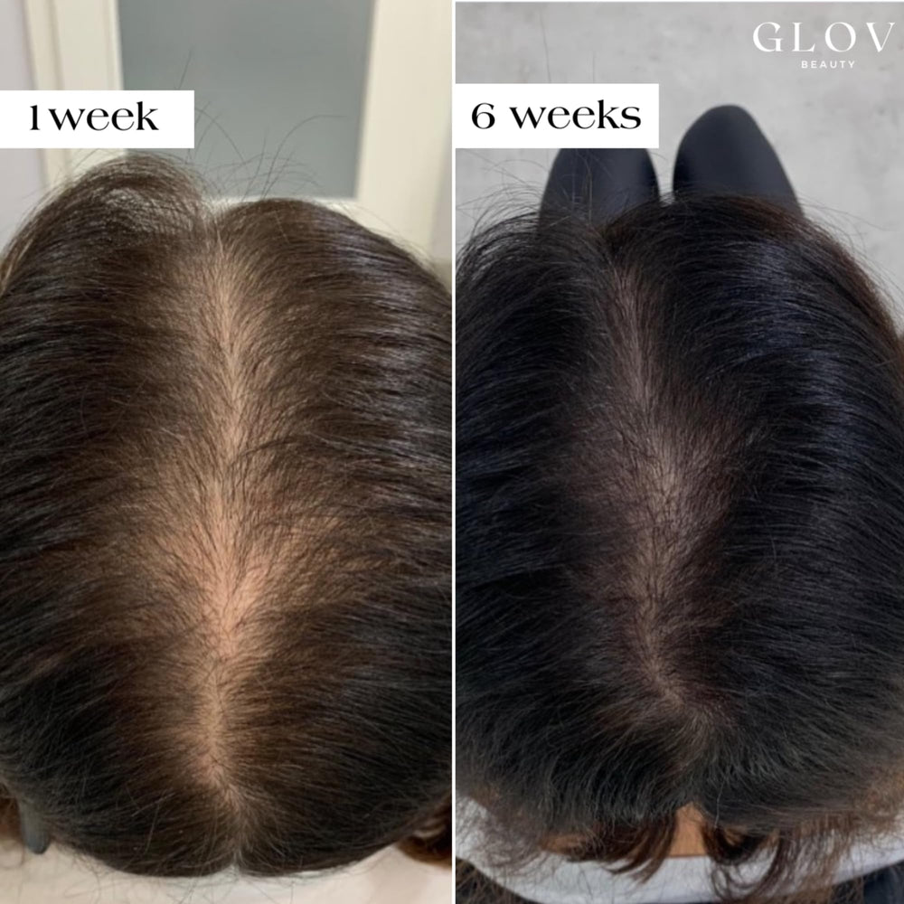 Glov Beauty peptide serum ampoules deliver 5ml each for nourishing scalp hydration.