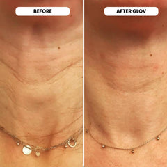 Twelve 5ml serum ampoules from Glov Beauty laid out for sessions.