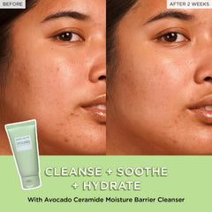 Glow Recipe Avocado oil aiding makeup removal while nourishing skin.
