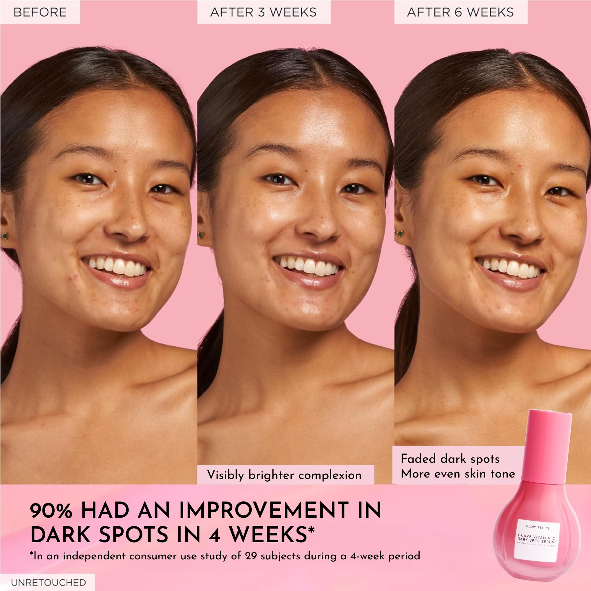 Tranexamic acid focus image communicates dark spots reduction potential
