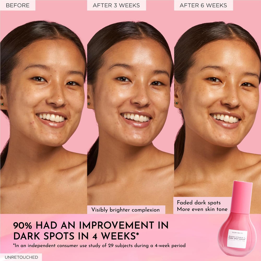 Tranexamic acid focus image communicates dark spots reduction potential