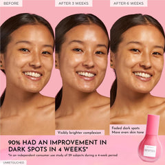 Tranexamic acid focus image communicates dark spots reduction potential