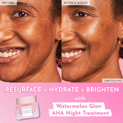 Glow Recipe Watermelon Glow Night Treatment swirl close-up emphasizes light gel texture.