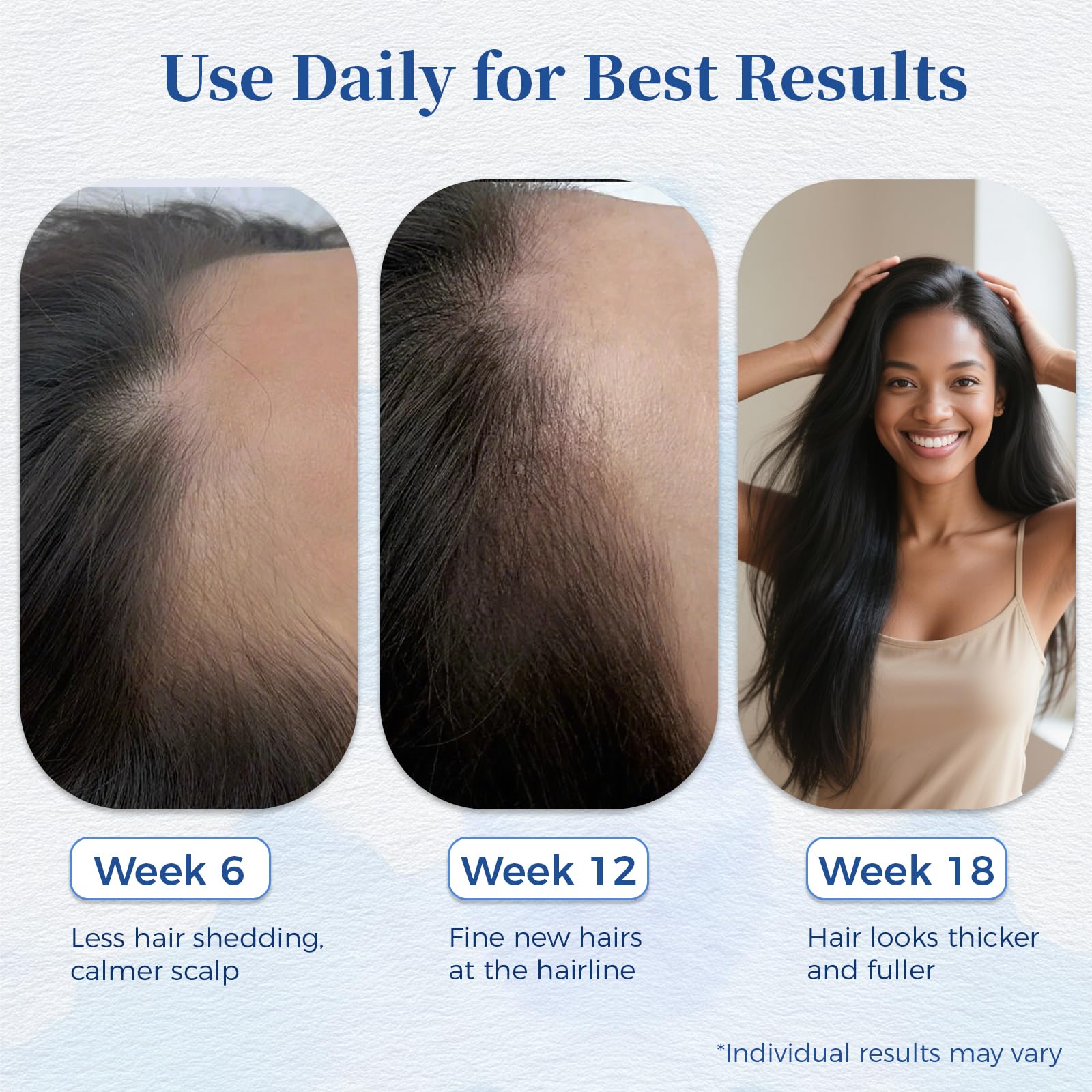 Gluvelessia rosemary serum features a non-greasy formula suitable for daily use