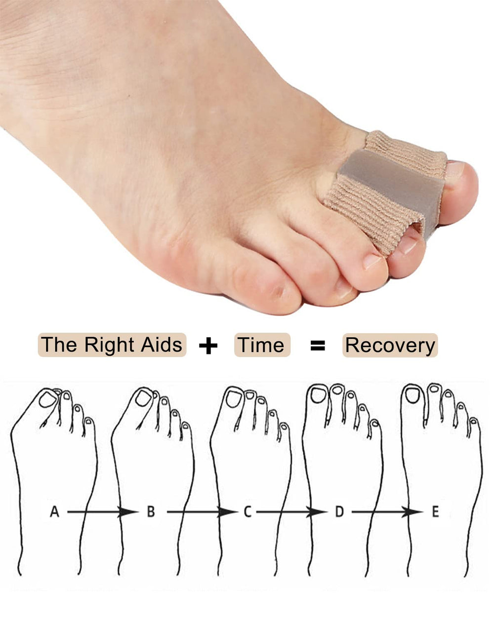 Golbylicc gel toe pads closeup highlighting soft, flexible material for cushioned toes.