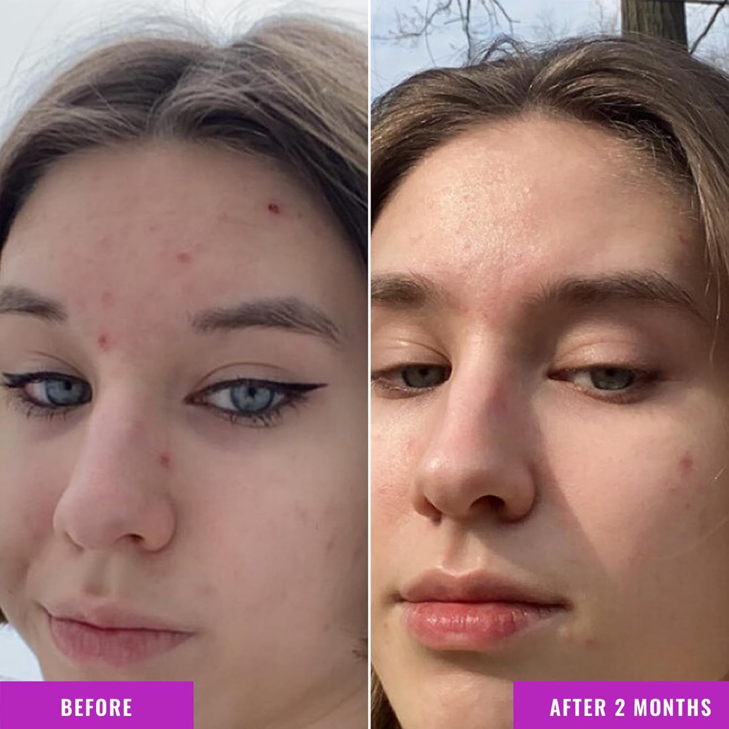 Good Molecules Niacinamide Serum Pack 2, gotas para aplicación suave y tono más uniforme.