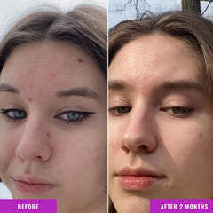 Good Molecules Niacinamide Serum Pack 2, gotas para aplicación suave y tono más uniforme.