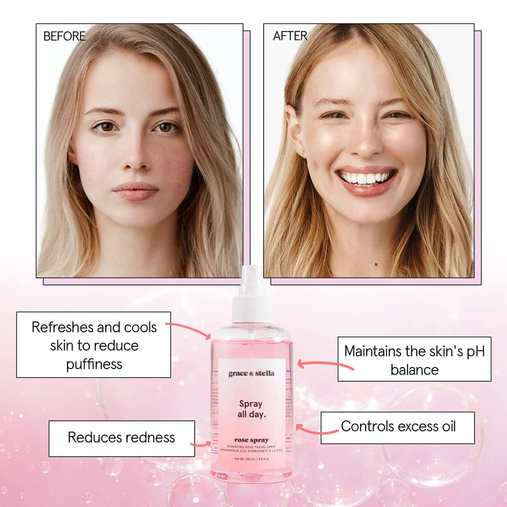Grace & Stella atomizador de rosas para aplicación suave.