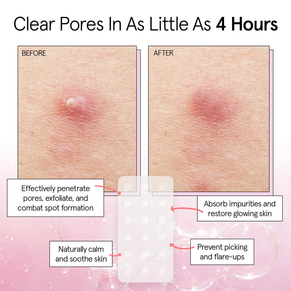 Grace & Stella clear hydrocolloid patch blends with skin