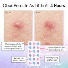 Grace & Stella parches acne nube azul protección suave nocturna
