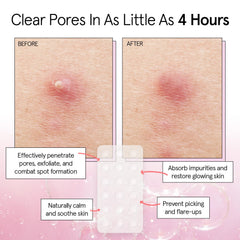 Parche acne translúcido Grace & Stella para uso discreto.