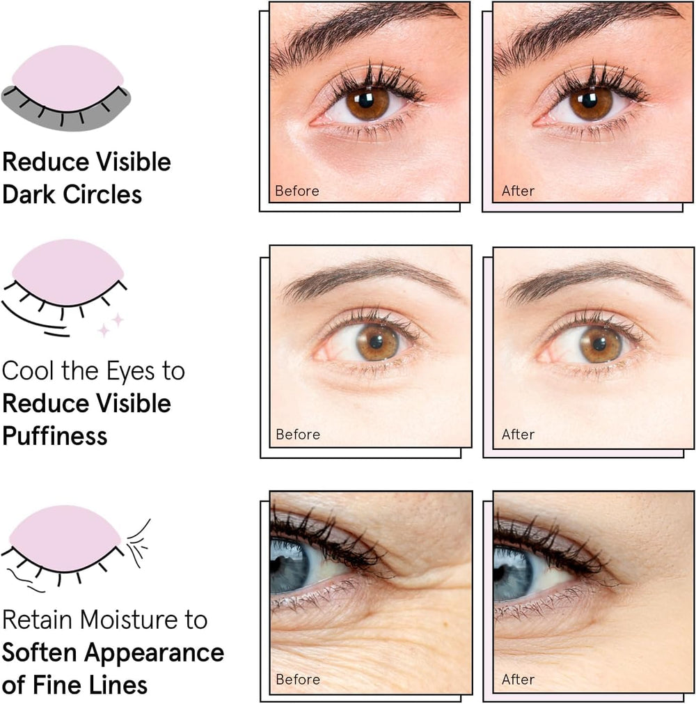 Grace & Stella patches for women and men seeking refreshed eyes