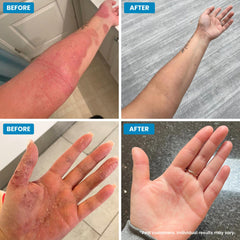 Close-up of Grahams Natural C+ eczema cream texture for easy application.