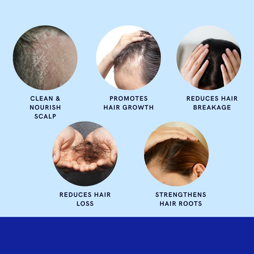 GREEN ROYALTY Minoxidil Shampoo on bathroom counter illustrates daily hair care ritual.