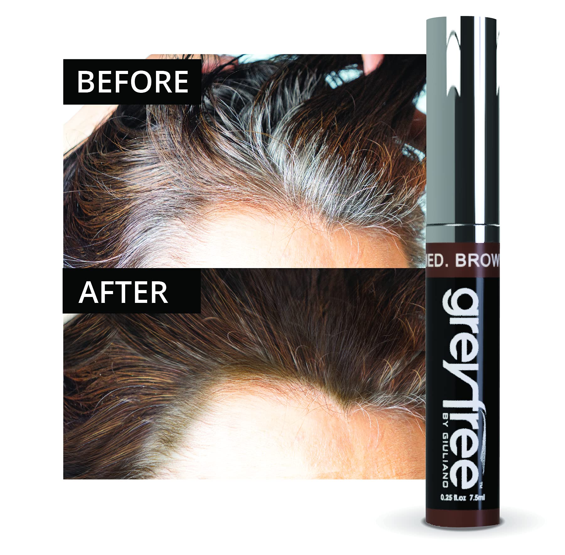 Greyfree hairline concealment creates a soft, natural finish at the edge.