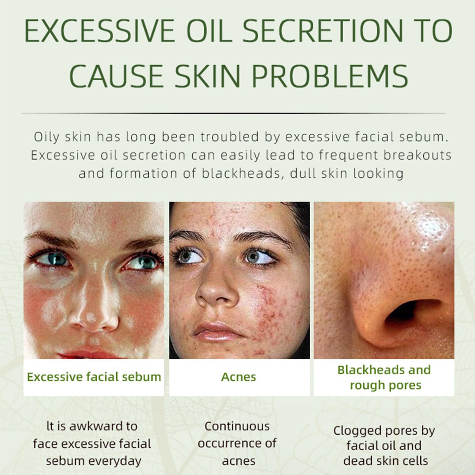 Grospe Acne Removing Cream texture appears smooth and lightweight for everyday use
