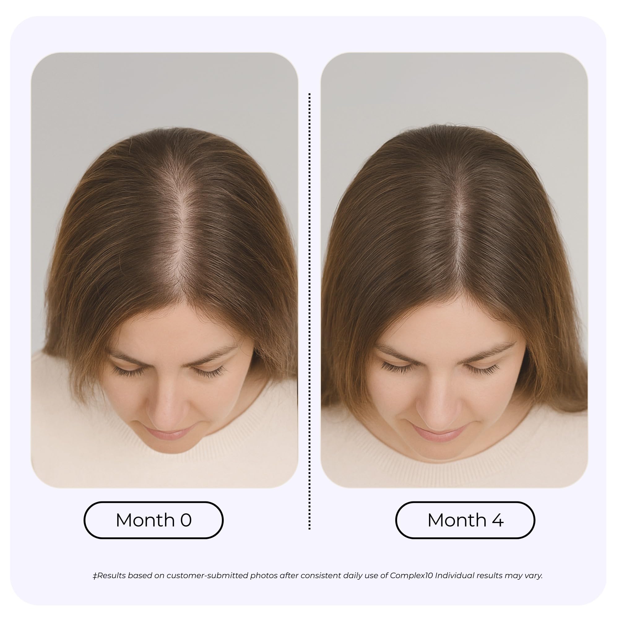GROWPLEX Complex10 capsules blister pack ready for everyday hair care routine