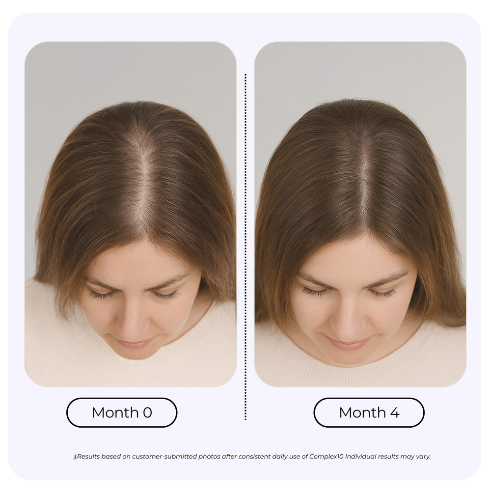 GROWPLEX Complex10 capsules blister pack ready for everyday hair care routine
