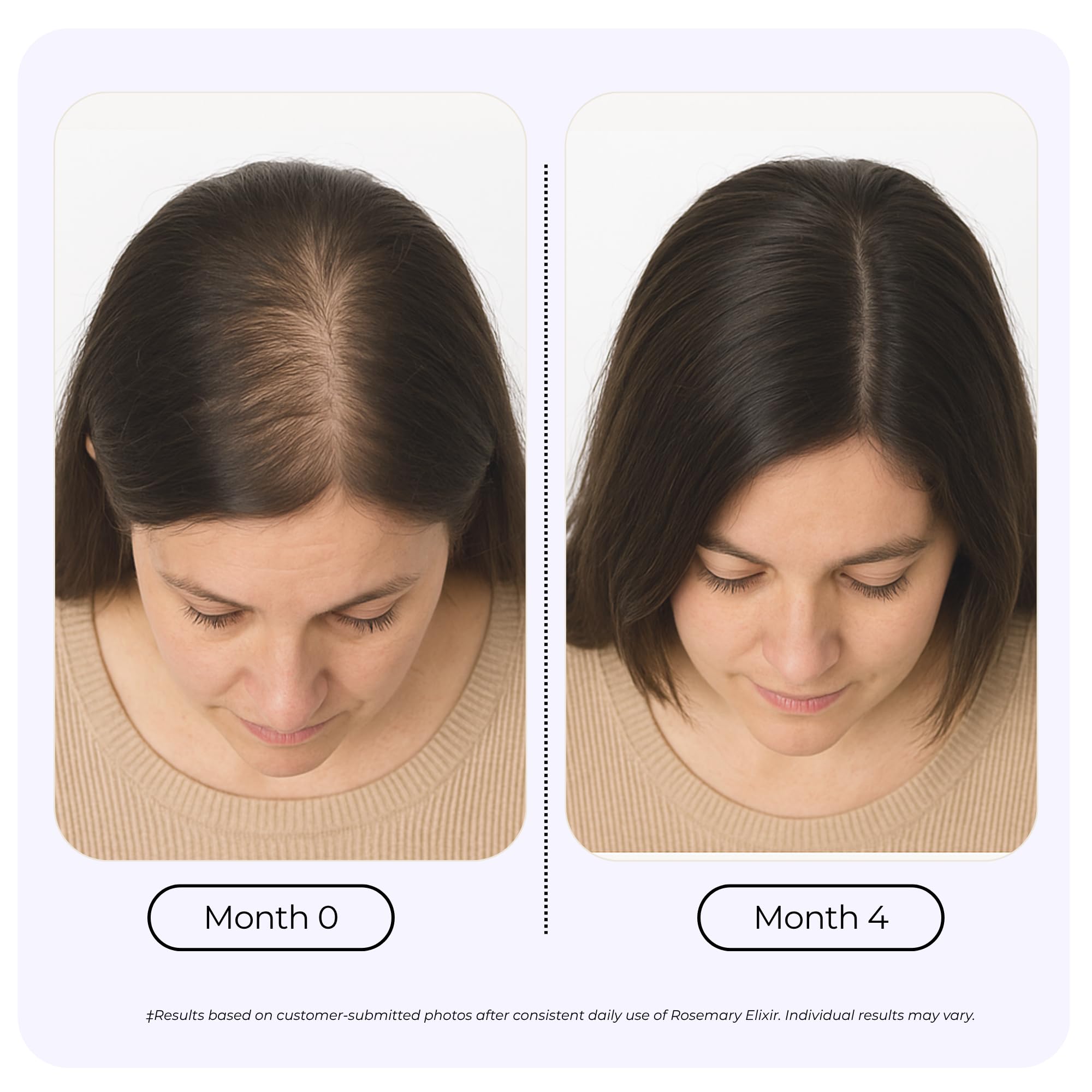 Growplex Rosemary Elixir on the scalp promotes a clean, non-greasy feel.