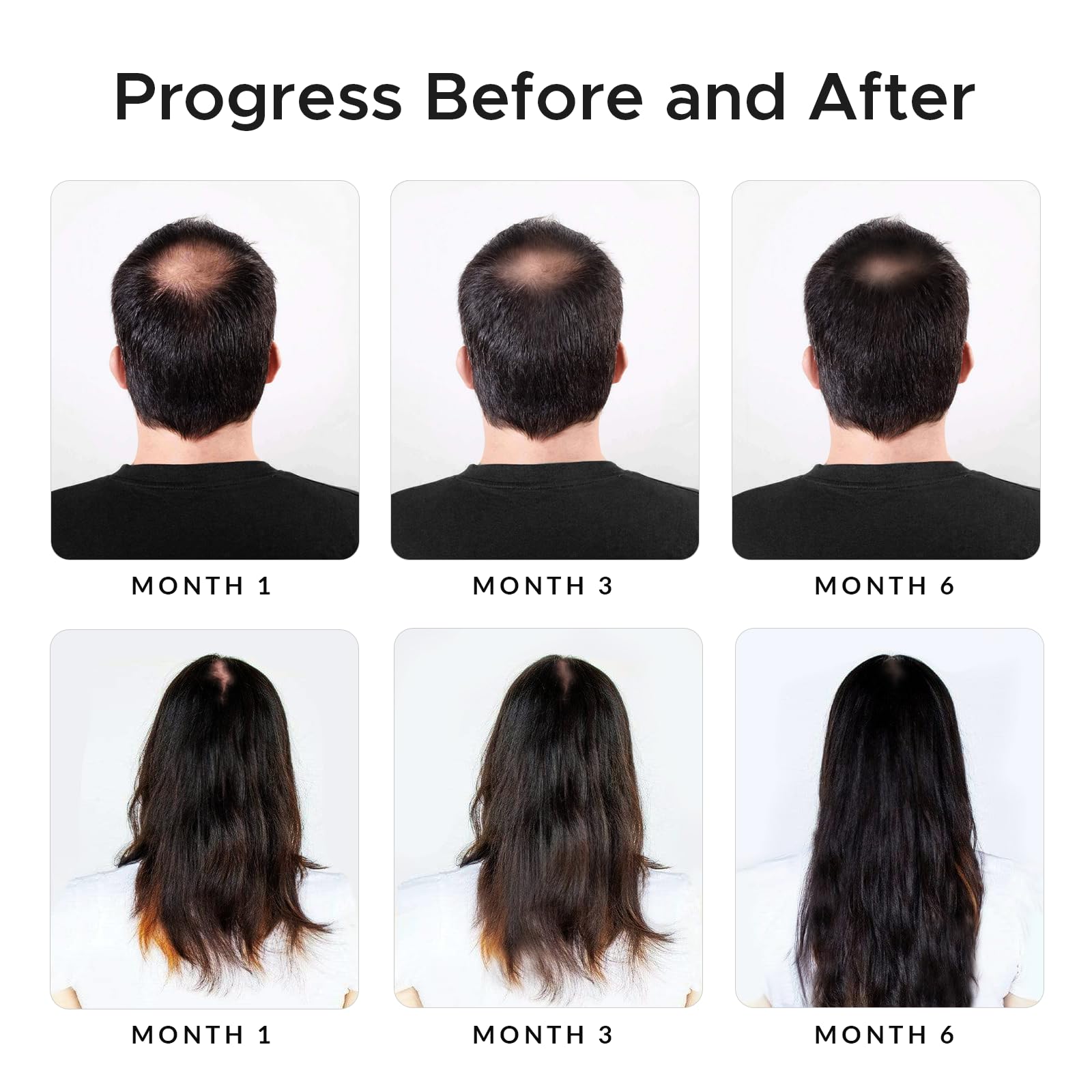 Growth Essence Minoxidil Shampoo application scene on scalp