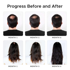 Growth Essence Minoxidil Shampoo application scene on scalp