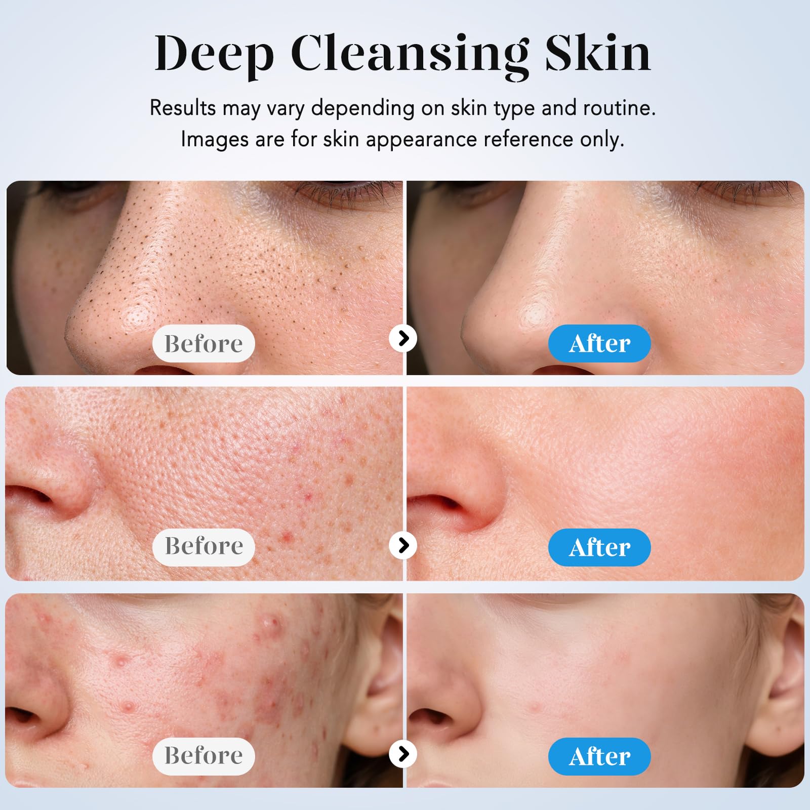 GUGUG Skin Scrubber ion mode aids product absorption.