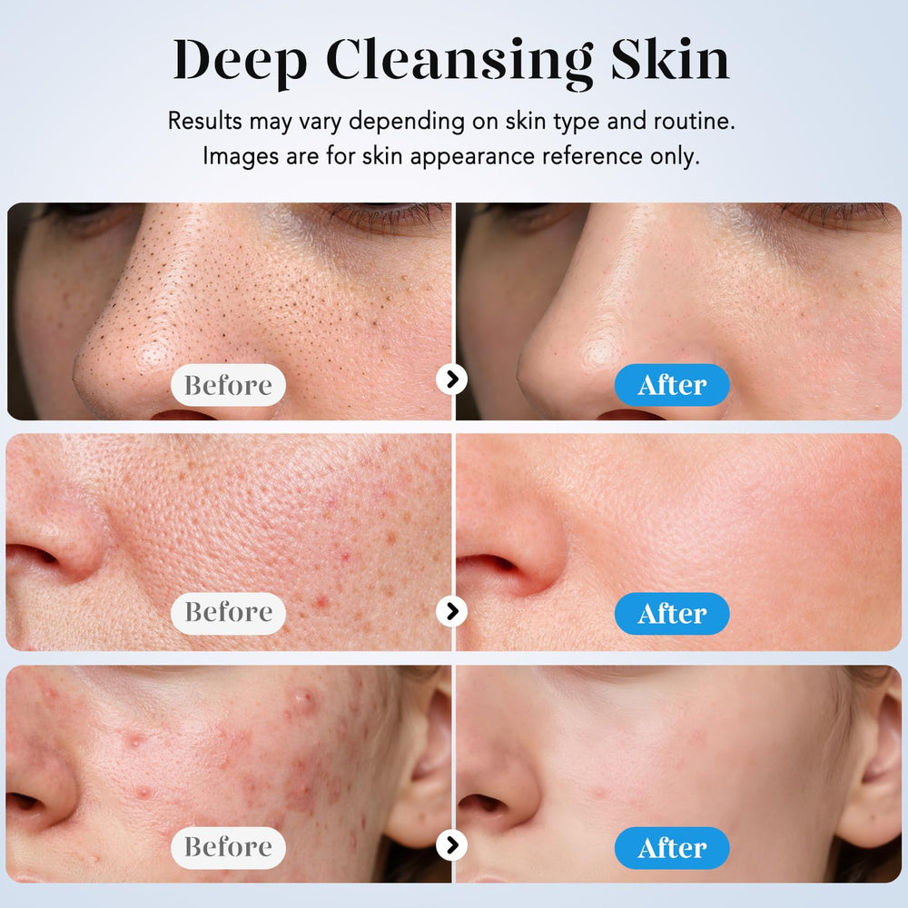 GUGUG Skin Scrubber ion mode aids product absorption.