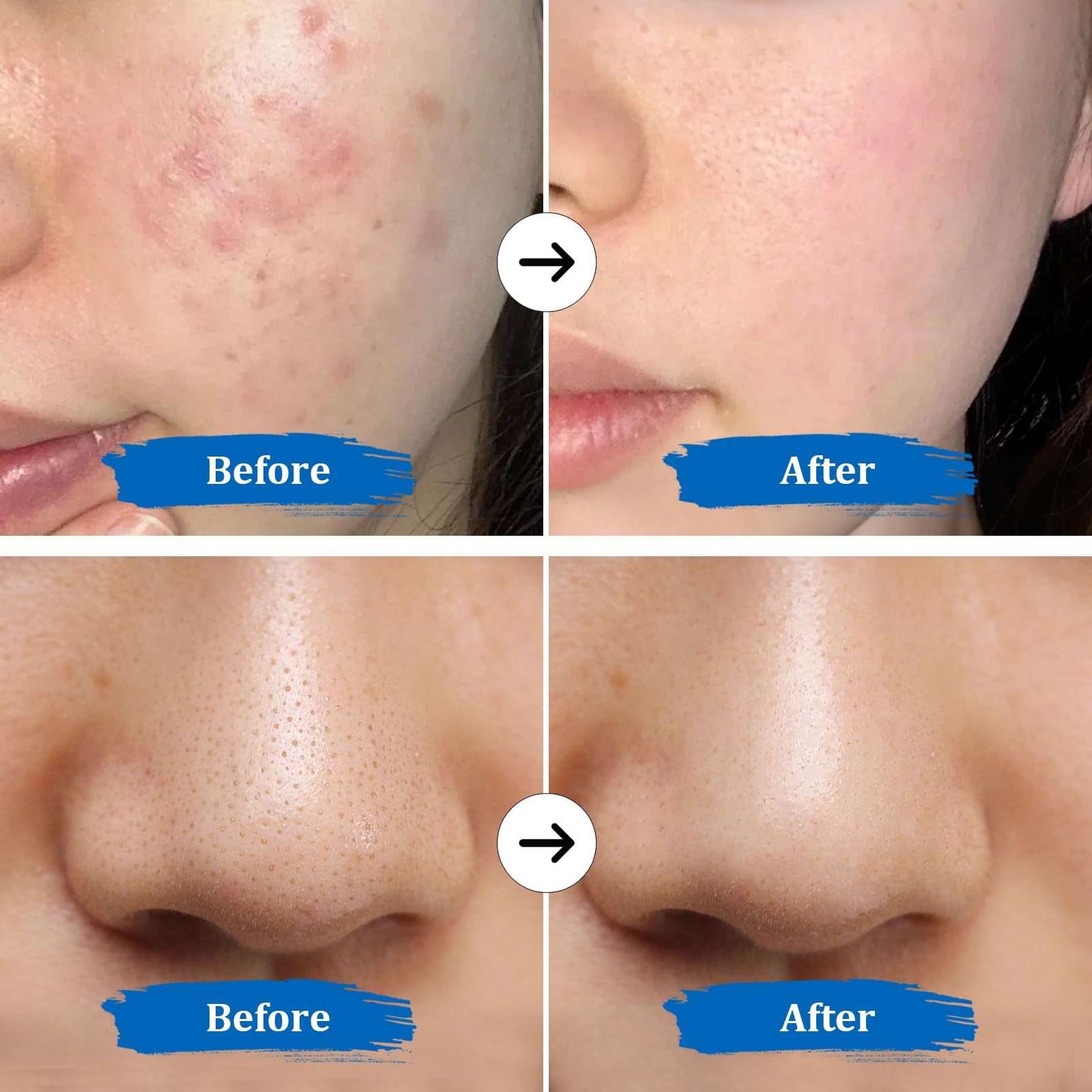 GUGUG Skin Scrubber lifting mode provides a gentle facial massage.