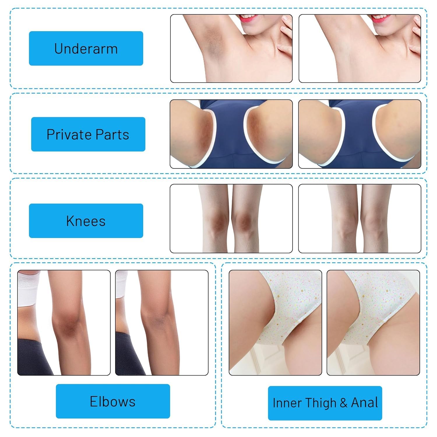 Gukei crema blanqueadora rodillas, suaviza y aclara discretamente.