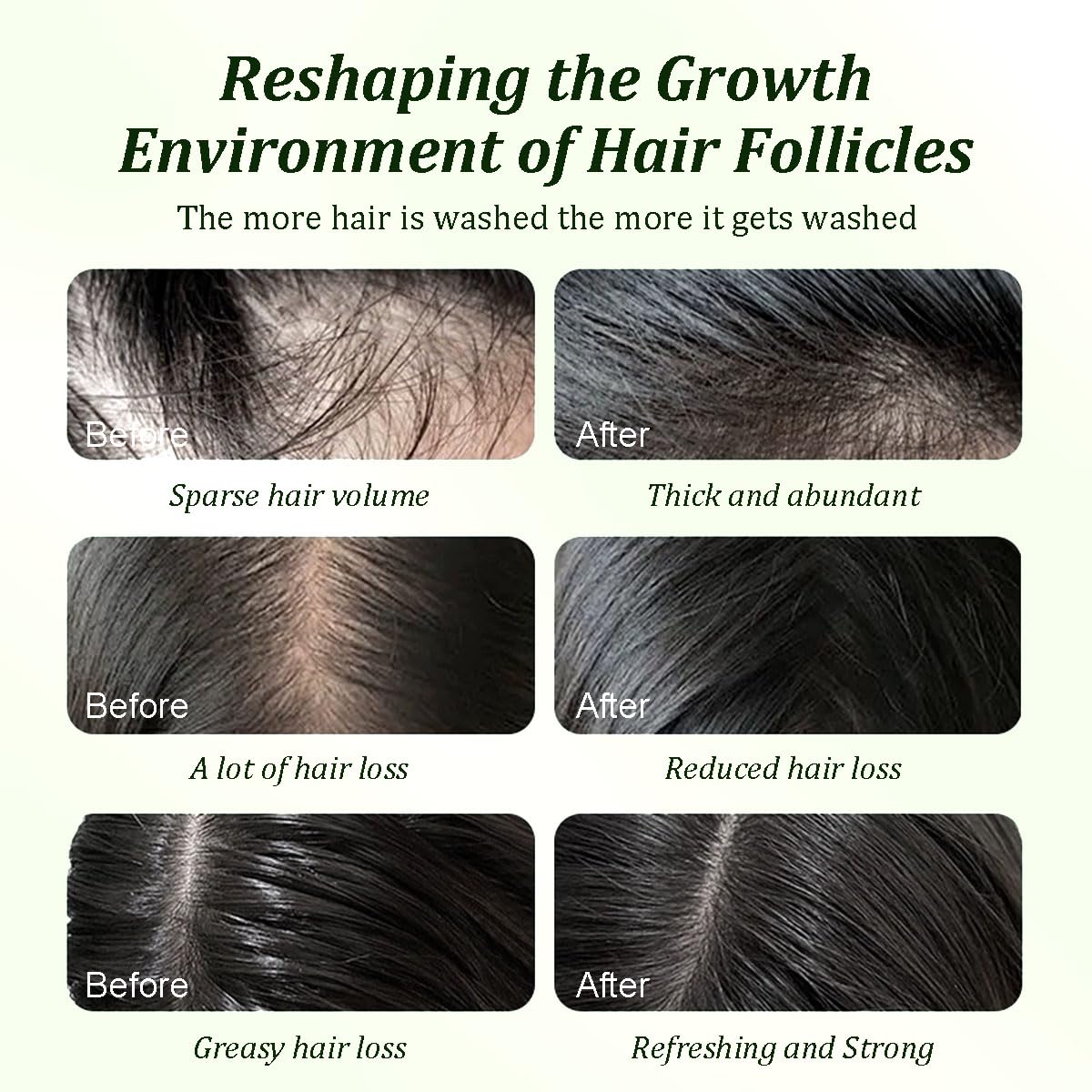 Gypsophila Batana Oil Shampoo scalp nourishment close-up highlights refreshed roots
